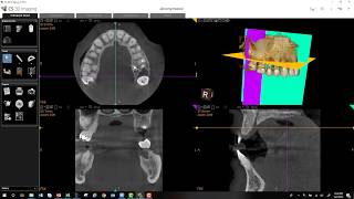 Celebrity CS 3D Imaging Basic Usage Tutorial - Version 3.10.4 Profile