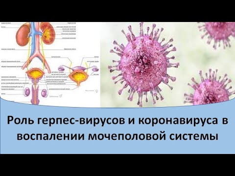 Роль герпетических инфекций и коронавируса в воспалении мочеполовой системы.