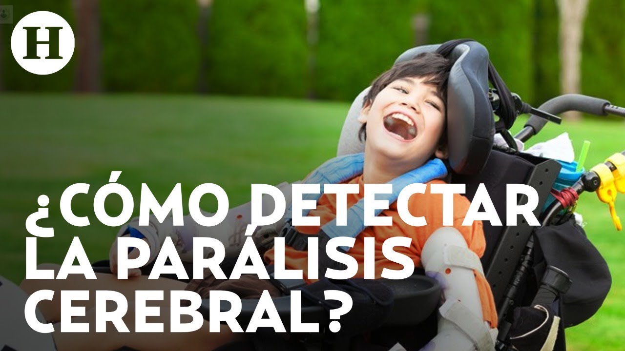 Parálisis cerebral puede presentarse durante la gestación, el parto o la niñez temprana | Médico H