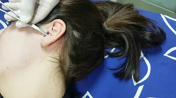 ¿Con qué perforan el daith?