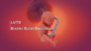 Lower Urinary Tract Obstruction Johns Hopkins Center For Fetal Therapy