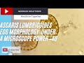 morphology of Ascaris lumbricoides (roundworm ) fertilized egg-  stool microscopy