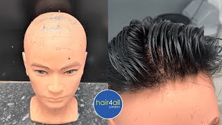 SUPER CLOSE UP! HAIR SYSTEM | Before & After Non-Surgical Hair Replacement System Men/Women UK