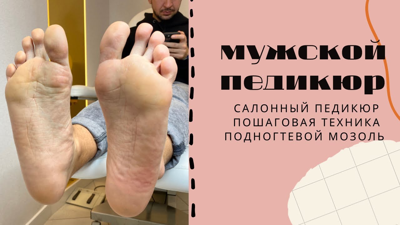 МУЖСКОЙ ПЕДИКЮР - YouTube