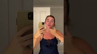 How to Soothe Sunburn Part 1