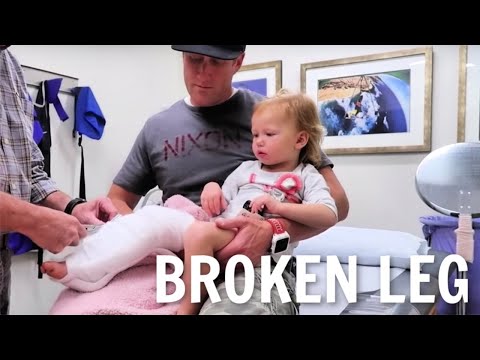 Getting a cast on her Broken leg!
