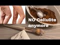 Get rid of cellulite with this  BODY SCRUBS&quot; cellulite treatment on thighs &amp; bum