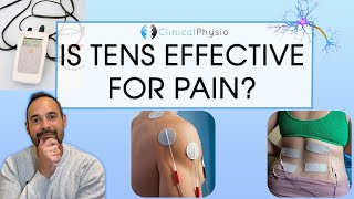 Does TENS Actually Work? | Expert Physio Review