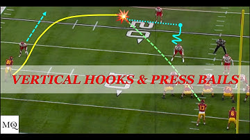 The Art of X Show (Mini): Vertical Hooks & Press Bail