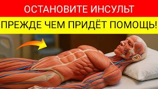 видео: Пожилые, Сделайте ЭТО До Прибытия Помощи — 3-Минутный Трюк Который Останавливает Инсульт! картинка: Пожилые, Сделайте ЭТО До Прибытия Помощи — 3-Минутный Трюк Который Останавливает Инсульт!