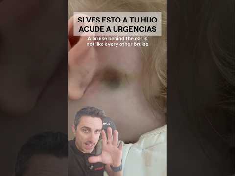 Si ves esto en tu hijo, acude a urgencias.#supervivencia #curiosidades #sabiasque