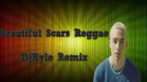 Maximillian-Beautiful Scars Reggae/DjRyle Remix