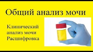 видео Анализы мочи