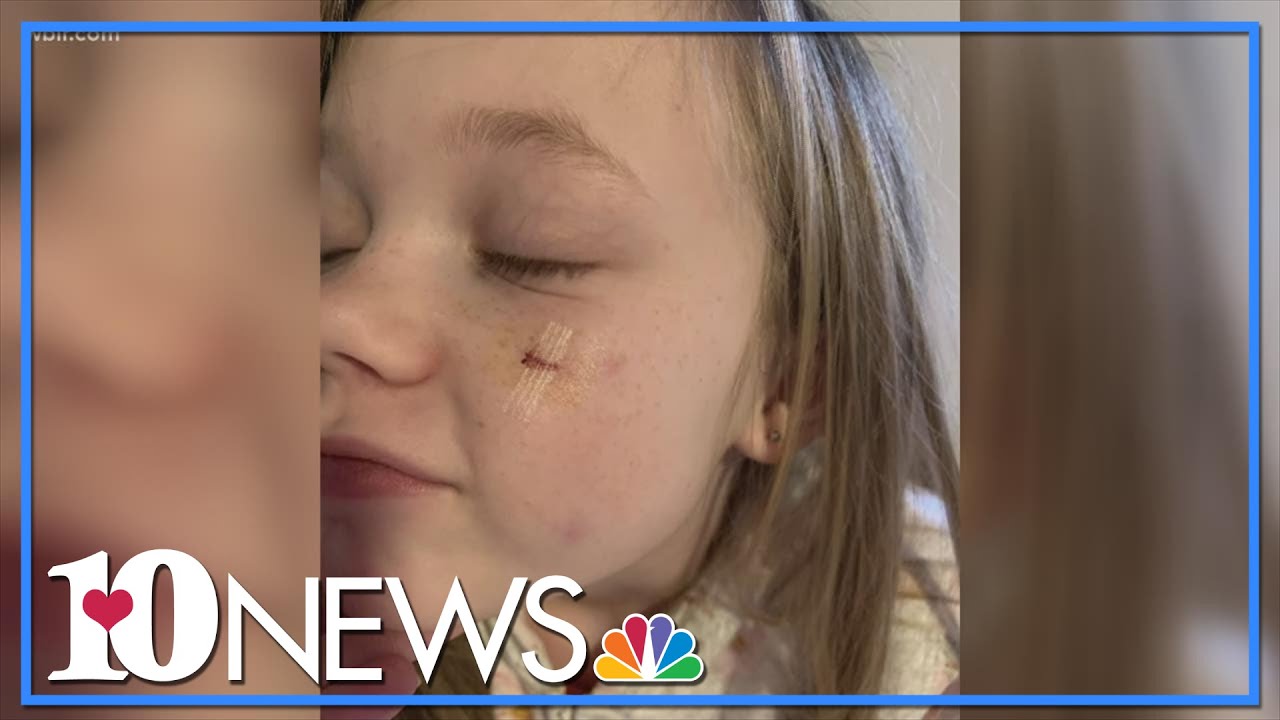 Knox County mom speaks out after dog attacks daughter twice