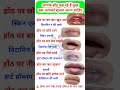आपक ह ठ क य बत रह ह शर र क स क र ट स क त ज न ए Lip Problem Causes GPSS HOME TIPS आपक ह ठ क य बत रह ह शर र क स क र ट स क त ज न ए Lip Problem Causes GPSS HOME TIPS