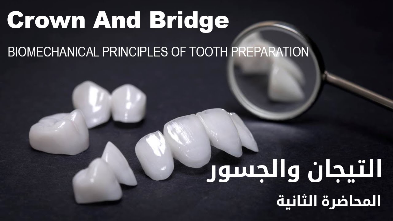 الجسور والتيجان المحاضرة الثانية - Crown & Bridge BIOMECHANICAL PRINCIPLES OF TOOTH PREPARATION