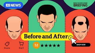 The cost of keeping your hair | Before and After Episode 1 | Background Briefing
The cost of keeping your hair | Before and After Episode 1 | Background Briefing The cost of keeping your hair | Before and After Episode 1 | Background Briefing