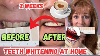 Comment blanchir VRAIMENT les taches sur les dents à la maison ! Avis sur la brosse à dents blanc... screenshot 1