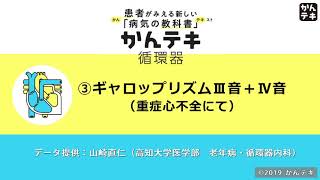 ③ ギャロップリズム Ⅲ音+Ⅳ音（重症心不全にて）