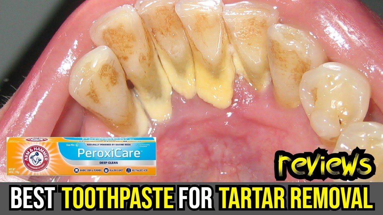 Best Toothpaste For Plaque And Tartar Removal 🦷 Revolutionize Your Smile: Top 3 Tartar Removal Toothpastes Reviewed