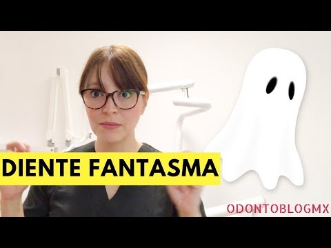 Vídeo: Què és l'odontoplàstia dental?