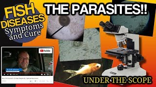 Fish parasites under the microscope Ich Trich Costia Chilodonella Flukes and Argulus