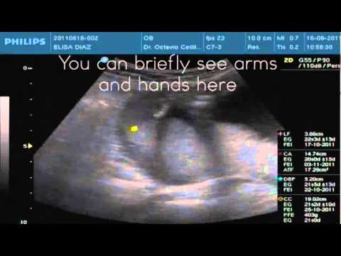 What an Ultrasound looks like: Baby #2 at 21 Weeks - YouTube