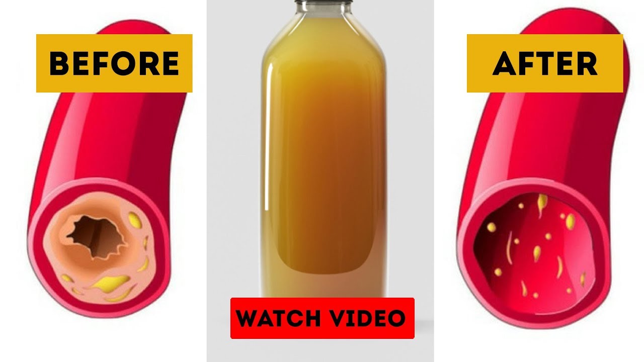 ginger for heartworm prevention This powerful Juice Remove Clogged Arteries and Control Blood Pressure