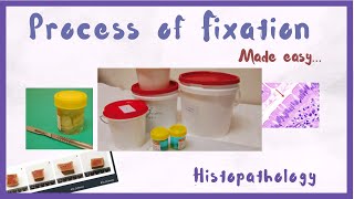 What is Fixation | Tissue Fixation in Histology |  Hindi | Histopathology