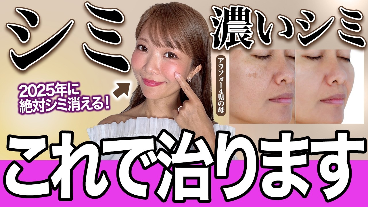 【2025年最新版】シミをなくしたい人が知っておくべき習慣5選を紹介します【しみ対策 美白ケア】