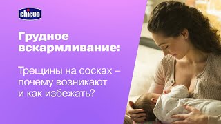 Трещины на сосках — почему возникают и как избежать? Ответы от врачей 0+