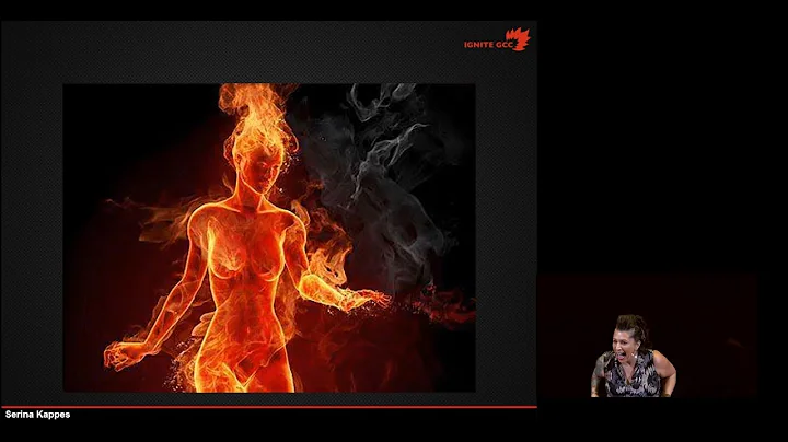 Serina Kappes Ackerman: I Was Burned Alive in Cost...