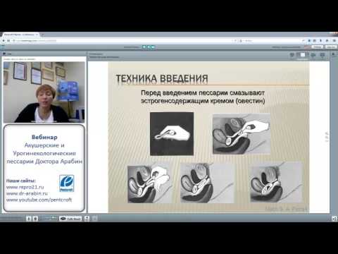 Вебинар: Акушерские и Урогинекологические пессарии Доктора Арабин 10.11.2014г.