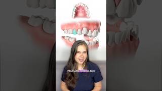 Extracción de premolares #shortvideo #dentista #bracket #ortodoncia #viral #greenscreen #shorts