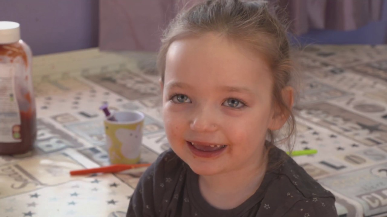 Dravet Syndrome - Paige's Story - YouTube