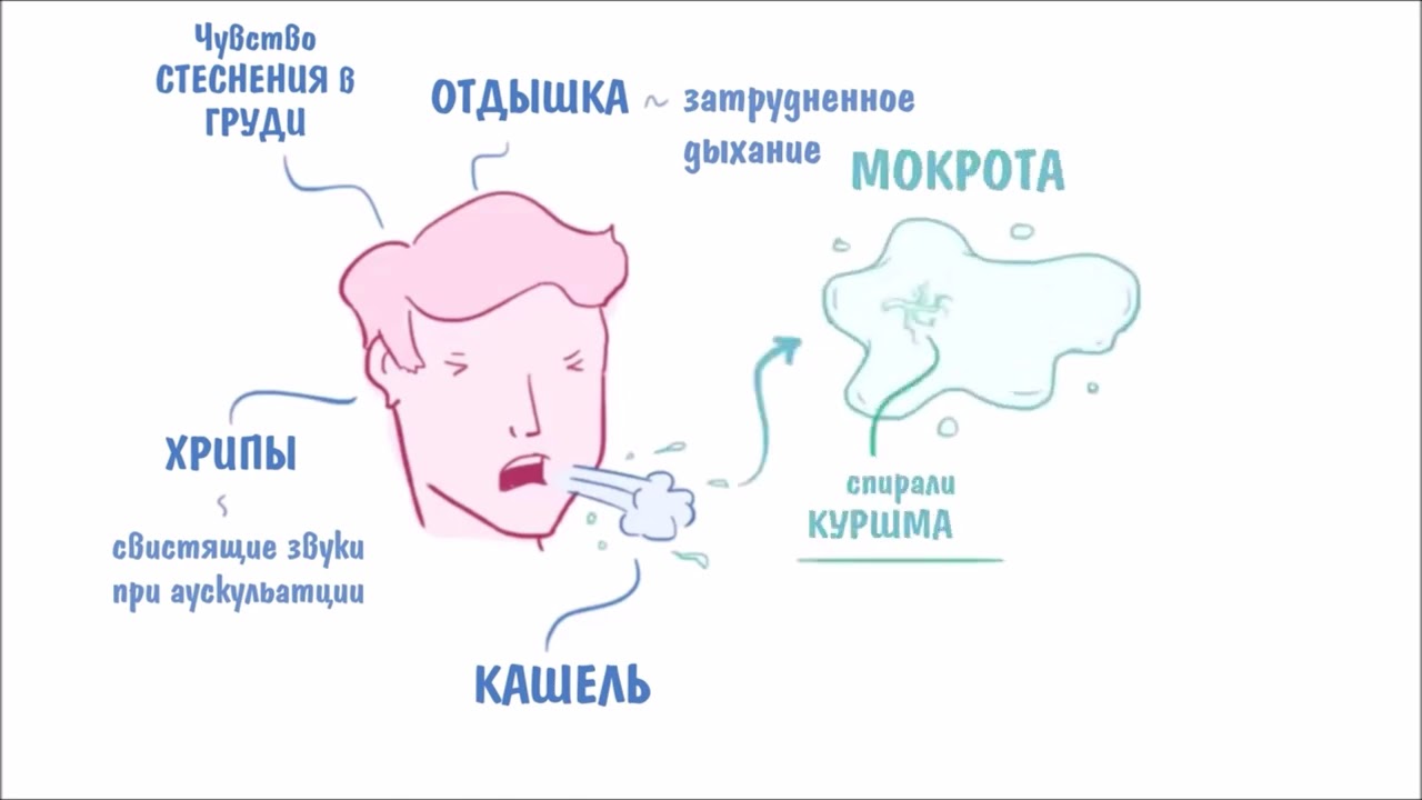 Бронхиальная АСТМА — причины, симптомы, патогенез, диагностика, лечение