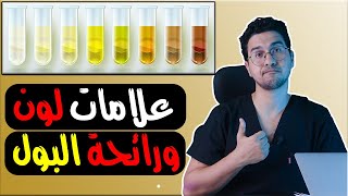 تغير لون البول وماهو لون البول الطبيعي |  علامات ألوان البول | رائحة البول