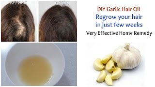 DIY Garlic Hair Oil for super hair growth | Regrow your hair | 100% effective screenshot 1
