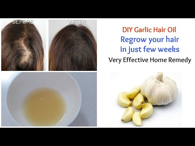 Incredible Benefits Of Garlic For Hair Femina In