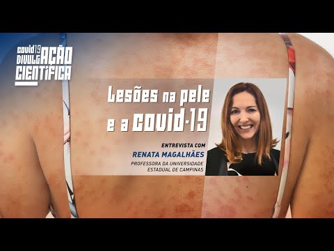 Vídeo: Covid causa lesões na pele?