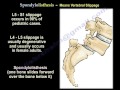 Spondylolysis,Spondylolisthesis,Spondylitis&Spondylosis-EverythingYou Need To Know-Dr.Nabil Ebraheim