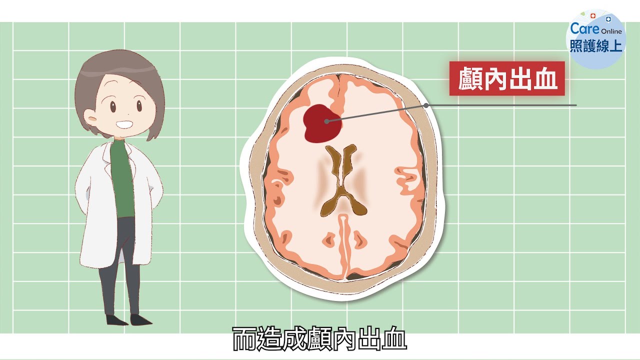 撞到頭，何時該就醫？ - YouTube