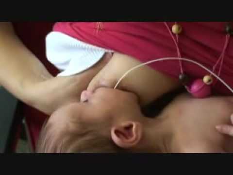 Inserting A Lactation Aid - Feeding Baby