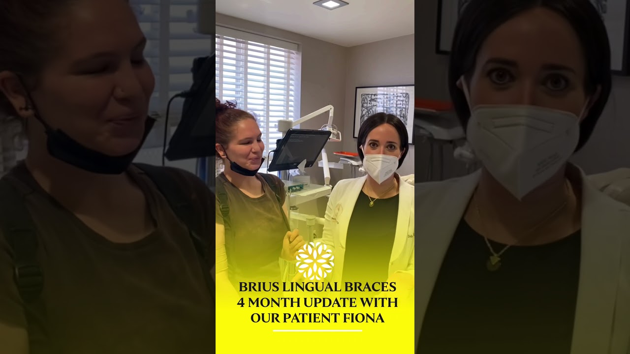 Brius Lingual Braces &bull; 4 Month Update with our Star Patient Fiona 🌟 #InvisibleBraces #BRIUS
