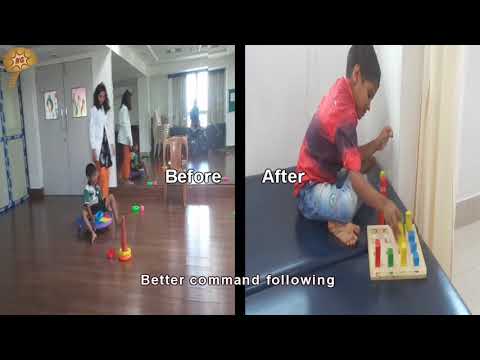 Improvements seen in 3 months after Attention-Deficit/Hyperactivity Disorder Treatment thumbnail