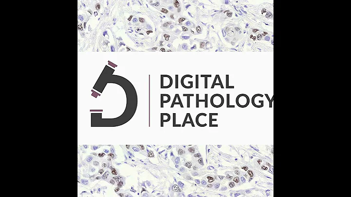 91: Using AI in Pathology to Benefit Patients w/ Mariano de Socarraz, CorePlus