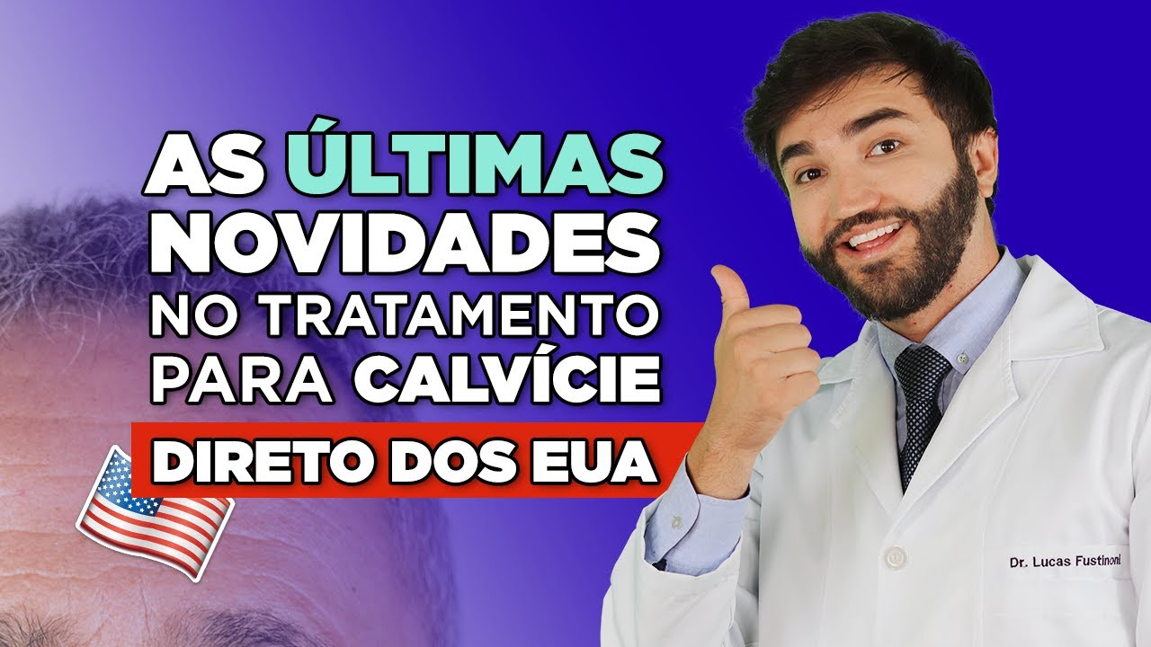 Últimas novidades direto dos EUA 🇺🇸 para calvície