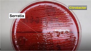 Serratia Liquefaciens, Citrobacter Freundii And Klebsiella Pneumoniae Growth On Cled Of Urine Cultur