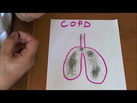 copd-treatment-with-antibiotics?-management-and-treatment-of-copd
