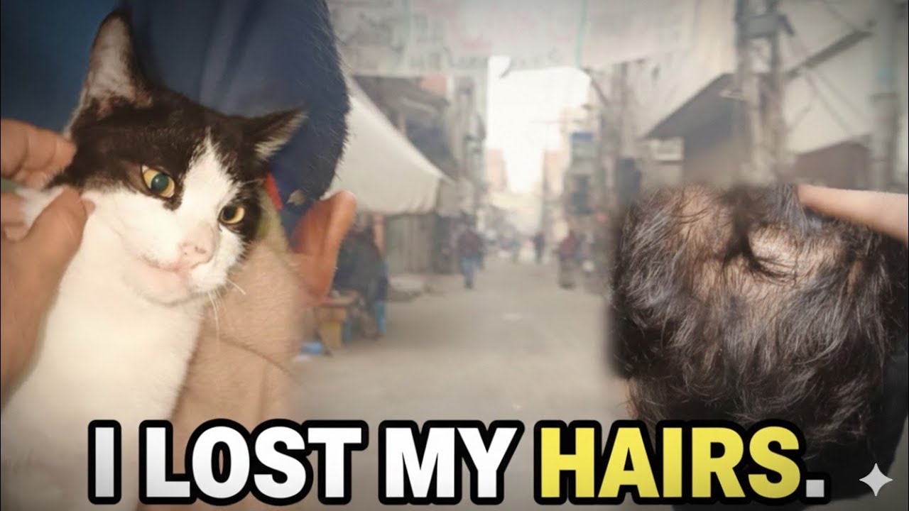 “Hair Loss at 20 Changed My Life | Intro Vlog” 